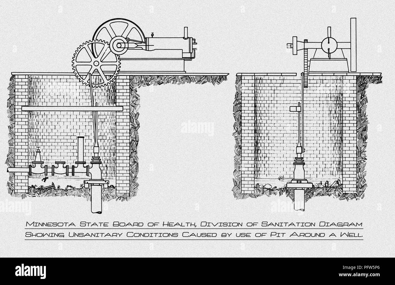 Costruito erroneamente trapanato comunale ben, migliorate digitalmente e colorato disegno istruttivo, 1919. Immagine cortesia di centri per il controllo delle malattie (CDC) / Minnesota Department of Health, R.N. Libreria Barr, Bibliotecari Melissa Rethlefsen e Marie Jones. () Foto Stock