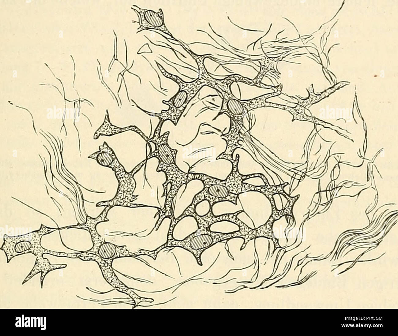 . Cursus der normalen Histologie zur Einführing in den Gebrauch des Mikroskopes, sowie in das practicche Studium der Gewebelehre. Istologia; microscopia. Die Bindesubstanzen. 127 2. Das Schleimgewebe (Fig. 36) steht zu dem insofern Fettgewebe in engeren Beziehungen, als es bei dem als embrione sub- cutanes Schleimgewebe die Stelle des Panniculus adiposus des Erwachsenen einnimmt, in welchen es sidi normalen im Laufe der Entwickelung allmählig umbildet. Es ist überhaupt vorzugsweise ein embryonales Gewebe, da es abgesehen von seinem Vorkommen un dem obengenannten Orte und einigen damit verwandten Foto Stock