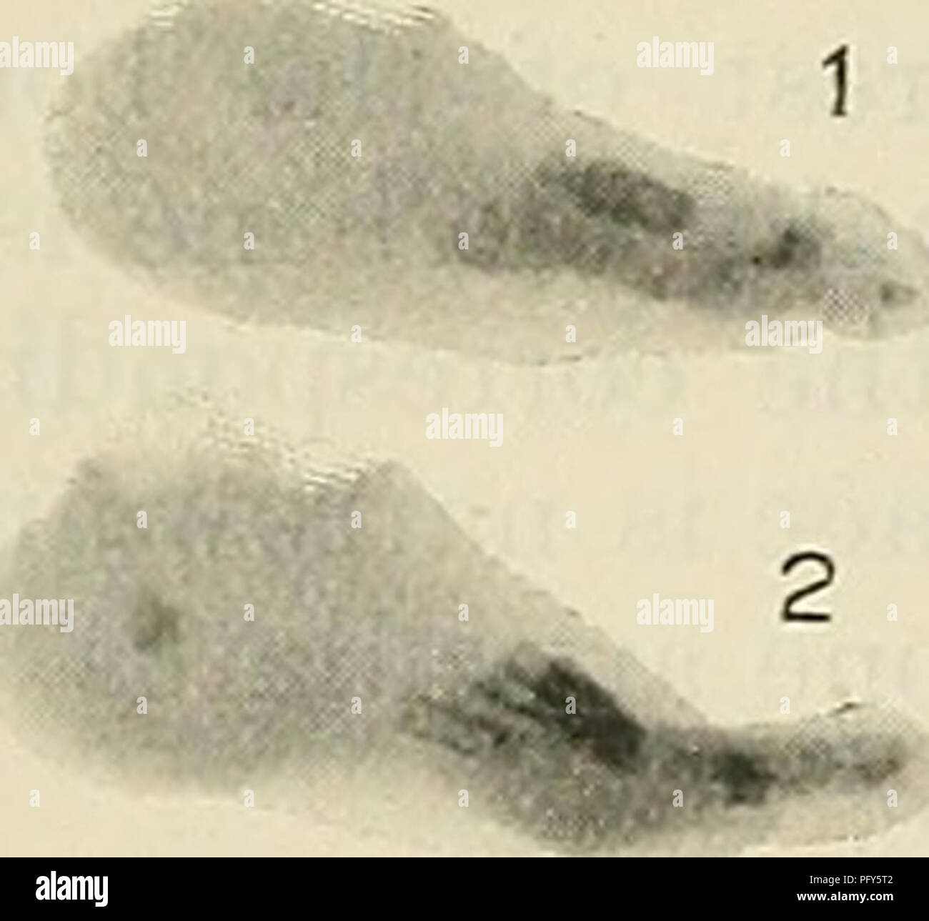 Questo testo di anatomia fornisce descrizioni dettagliate della struttura scheletrica umana, in particolare la scanalatura di tuberosità per il muscolo peroneus longus. Copre il suo rapporto con altre ossa e legamenti, offrendo un profondo approfondimento nei dettagli anatomici utili per studenti e professionisti di medicina. Foto Stock