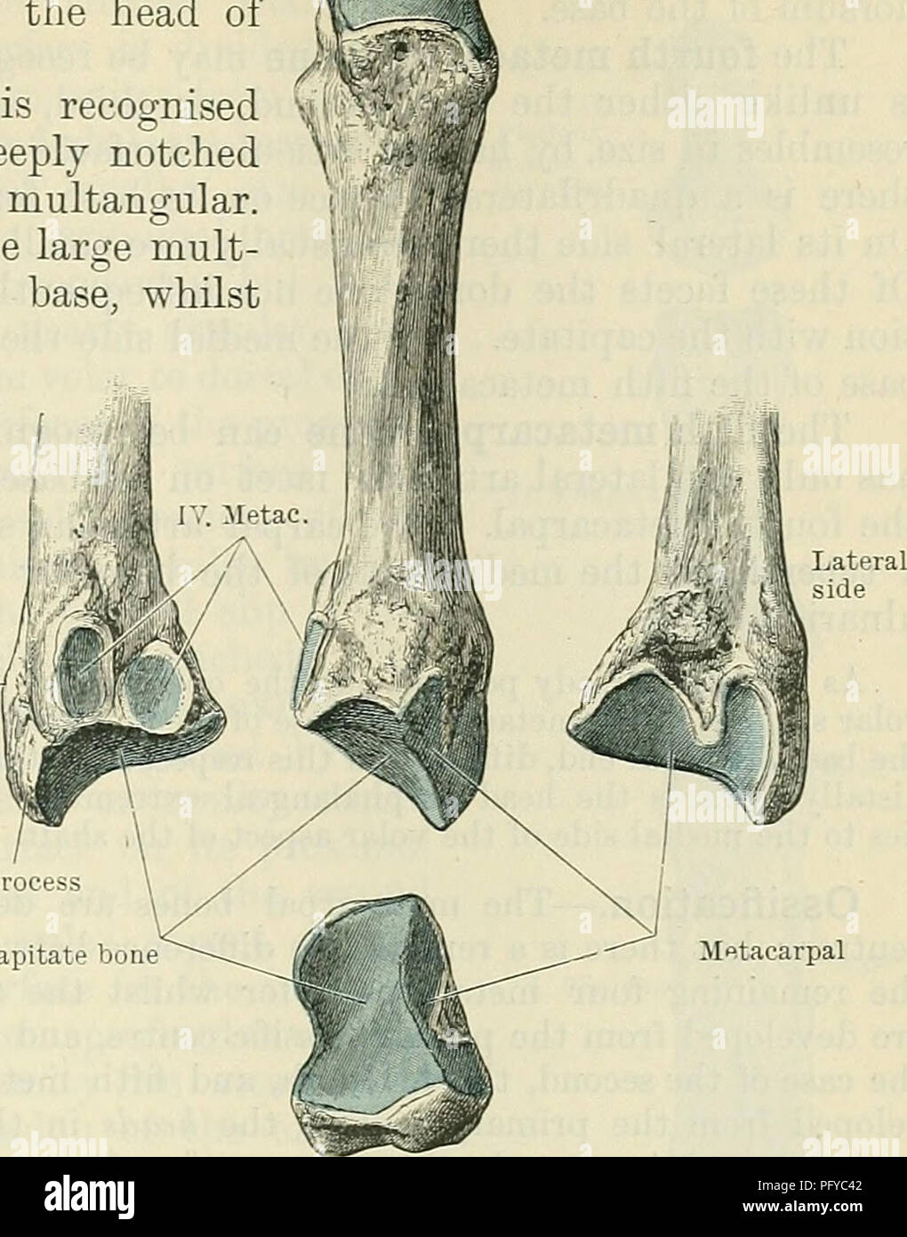 . Cunningham il libro di testo di anatomia. Anatomia. Il METACAEPUS. 225 longus muscolo è allegata. Il canale per il nutriente arteria è rivolta verso la testa dell'osso. Il secondo osso metacarpale è riconosciuta dalla sua lunghezza e la sua ampia e profondamente incavata della base per l'articolazione con il piccolo multangular. Ha un piccolo semi-oval facet per la grande mult angolare sul lato laterale della sua base, mentre sul suo aspetto mediale presenta una stretta striscia verticale per la capitate, di fronte alla quale ci sono due semi-superfici di forma ovale per il terzo metacarpale. Per l'aspetto dorsale della base è attaccare Foto Stock