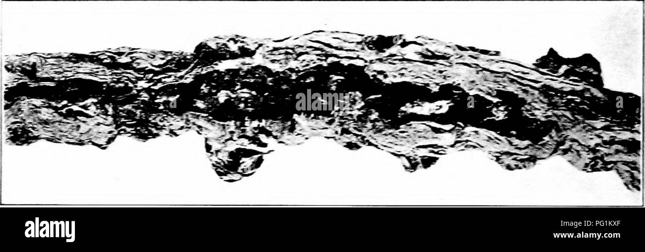 . Insetti dannosi : come riconoscere e il loro controllo . Pesti di insetto e pesti di insetto. 1"4 pesti di GAEJjEX AXD CEOPS campo alcune erbe infestanti, specialmente bardana e l ambrosia, sono il nativo di piante alimentari. Controllo consiste ia taglio e prontamente la distruzione di tali erbe infestanti ui o vicino le colture o le piante hanno attaccato. Il solo misure dirette fattibile sono la rimozione di stocchi infestati non appena la presenza dei dispositivi di prelievo è fJiscovered.. Fig. 11.. - "U 'Ì lc della Squa.^h Borer. Origiiial. Il Squash Borer (Mdittia satyriniJorrirU H!bn.) biancastra, carnosa, larve di circa un pollice lungo quando cresciuto, alesaggio Foto Stock