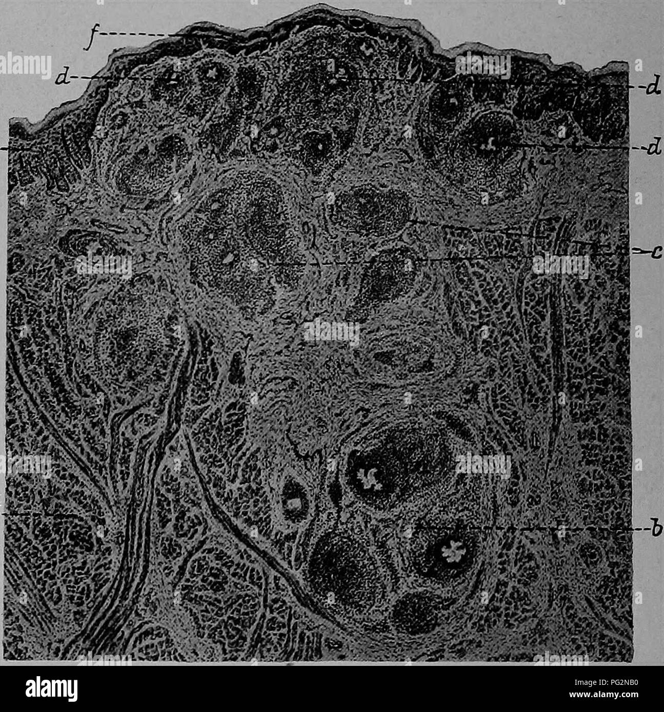 . La patologia e la diagnosi differenziale di malattie infettive degli animali : preparata per studenti e professionisti del settore della medicina veterinaria . Medicina veterinaria; malattie trasmissibili negli animali. 264 ACTINOMYCOSIS difficile e spesso grumose. La linguetta indurated possono essere erosi da attrito e varie deformazioni di quest'organo sono segnalati. Jcest ha dato un resoconto dettagliato dei cambiamenti istologici che avvengono in actinomycosis della lingua e delle mucose. Nella faringe. Qui la malattia di solito assume la forma di soft polipoidali fungoid o noduli o grumi con una superficie liscia e s Foto Stock