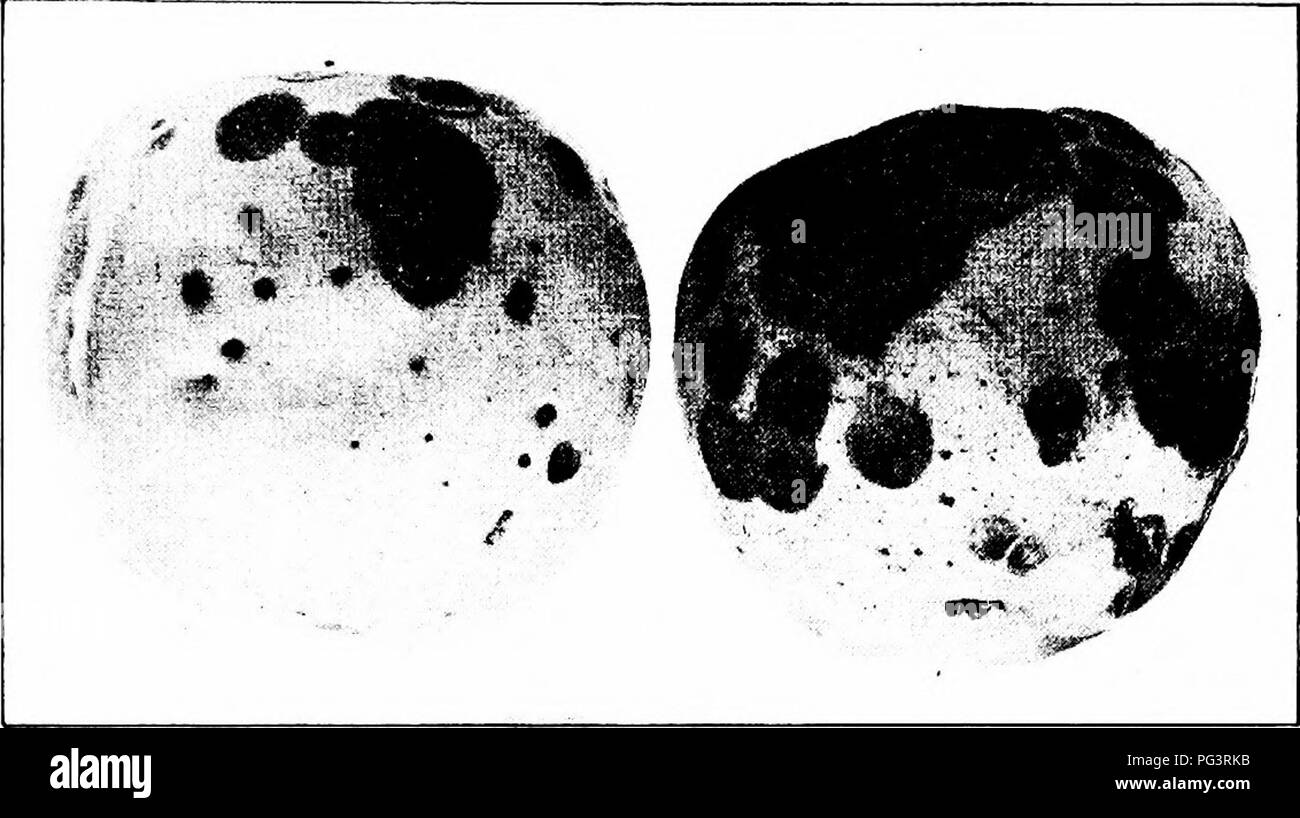 . Manuale delle malattie di frutta . Frutta. Malattie APPLE 133 con la fruttificazione pustole (Fig. 35, a sinistra); questi sono il più grande nella regione centrale della macchia e sono evidenti entro un quarto di pollice del margine. Se esaminato con una mano-lente, duro scuro marrone peli possono essere osservati sporgenti dai corpi fruttiferi.. Fig. 35. - Materiale spugnoso secco-rot; vari stadi di sviluppo. Questi costituiscono un importante segno di diagnosi della malattia. Il tessuto interessato è spugnoso e secco, donde il nome spugnoso di dry-rot. Cause. Questo apple-rot è causato dal fungo Volutella frudi. Con- nei corpi fruttiferi gli uomini Foto Stock