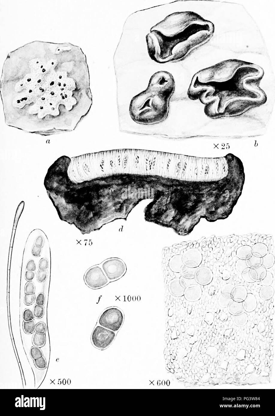 . Una monografia di licheni trovato in Gran Bretagna; essendo un catalogo descrittivo della specie nell'erbario del British Museum. I licheni. La piastra 25. X (iOO c ENCEPHALOGBAPHA CEREBRINA Koerb. una pianta sulla roccia. h. Porzione di tliallus e apothecia. c. Sezione verticale di thallui.. "I- sezione verticale di apothccium. r. Aschi paraphysis e. /. Spore. Ml. Si prega di notare che queste immagini vengono estratte dalla pagina sottoposta a scansione di immagini che possono essere state migliorate digitalmente per la leggibilità - Colorazione e aspetto di queste illustrazioni potrebbero non perfettamente assomigliano al lavoro originale. British Museum (naturale Hi Foto Stock