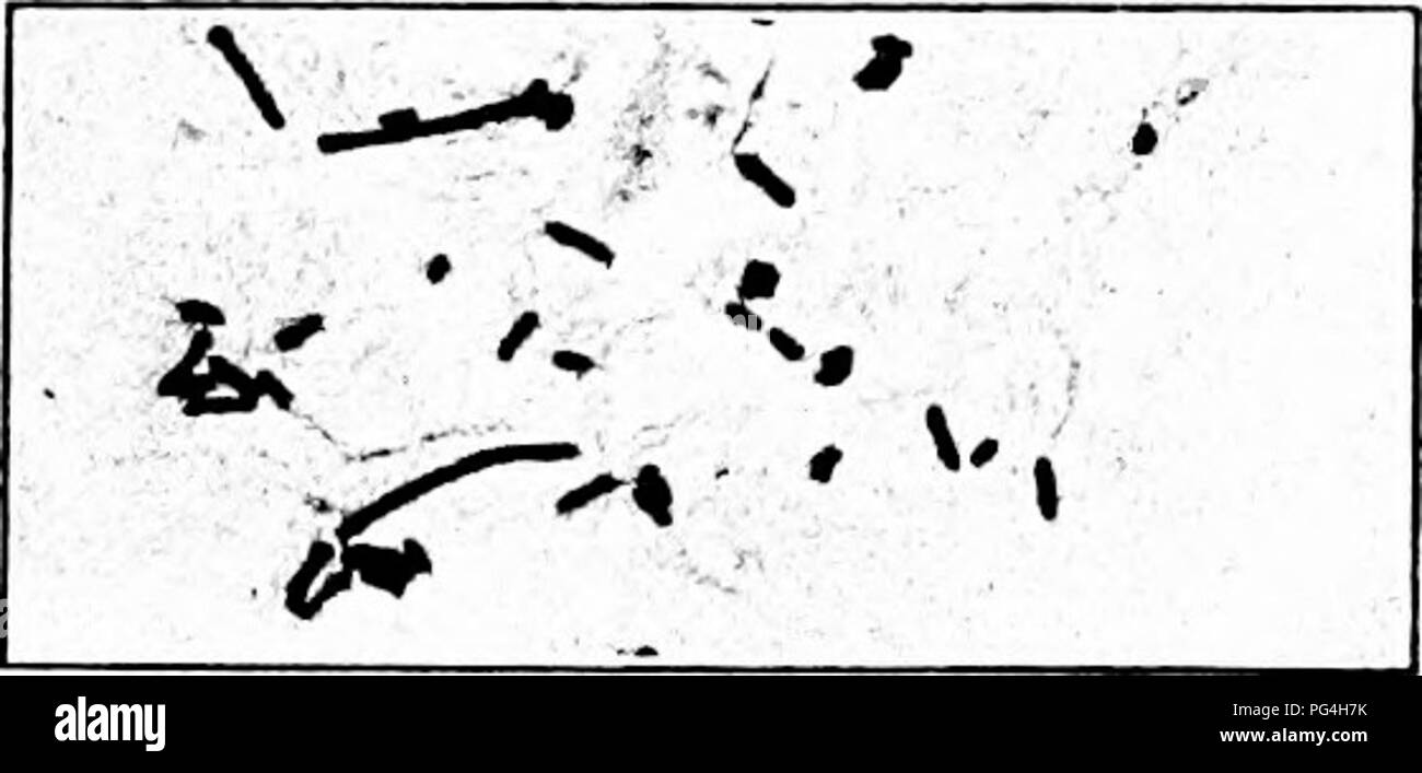 . I funghi che causano malattia vegetale . Le malattie delle piante; funghi. Fig. 25.-B. aroidese. Dopo Townsend. B. apii (Brizi.) Mig.'^ è riportato come la causa di un sedano rot, che è possibilmente identico con un marciume batterico ha riferito in precedenza da Halsted-'^ B. araliavorous Uyeda, descritto sul Ginseng in Corea è per- haps anche la causa del marciume molle di Ginseng in America.'^ l'organismo è stato isolato e studiato da Uyeda che hanno reso gli inoculi- zioni. Araliae Pseudomonas e Bacillus koraiensis erano anche com- monly presente nella malattia orientali.'' B. aroideae città. (Gruppo numero 221.2223022.) " 3 questo organismo Foto Stock