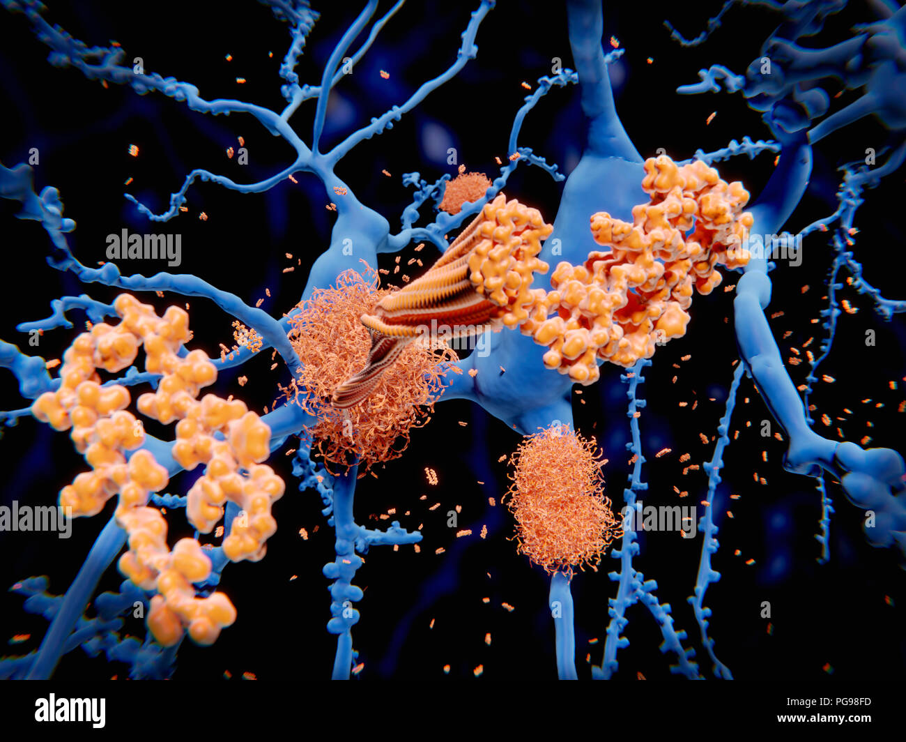 La proteina amiloide nella malattia di Alzheimer. Illustrazione dei processi che portano alla formazione di placche amiloidi (fasci aggrovigliati) sui neuroni (cellule nervose, blu). Placche amiloidi sono caratteristiche della malattia di Alzheimer. Essi conducono alla degenerazione dei neuroni interessati. I processi cellulari mostrato qui avviene dopo la beta-peptide amiloide è stata scissa dalla gamma e beta secretasi. Il residuo di amiloide lascia la membrana cellulare, cambia forma e si aggrega in lunghe fibrille. Queste fibrille formare dense le placche su cellule nervose. Foto Stock