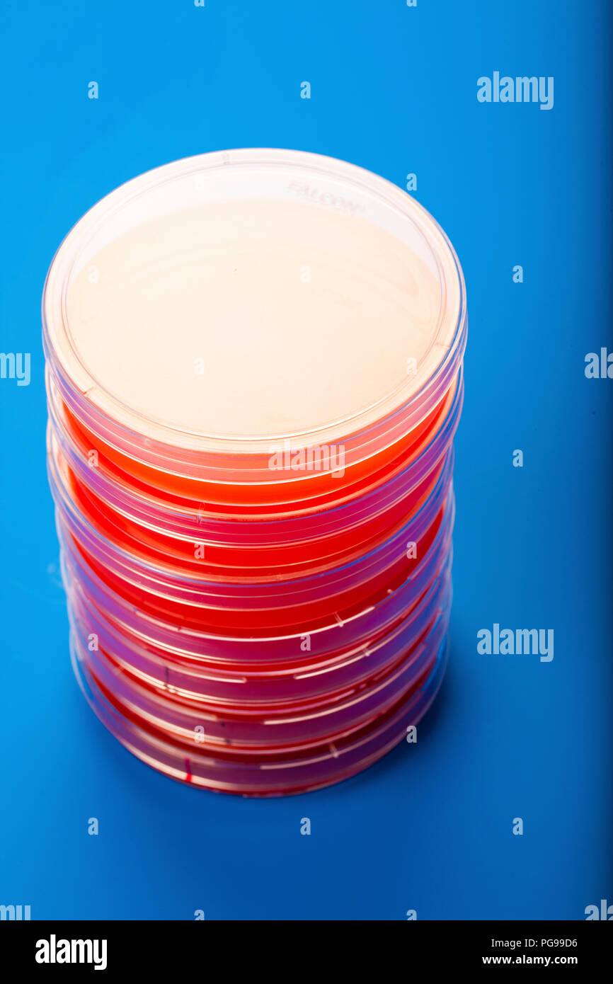 Capsule Petri con agar di sangue. Foto Stock