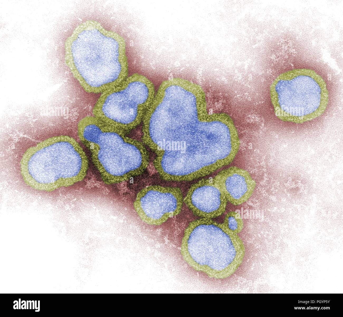 Fotografia di close-up di un verde giada e tinta blu campione di virus A di influenza (Famiglia Orthomyxovirus) su una terra rossa, Immagine cortesia CDC/FA Murphy, 1976. () Foto Stock