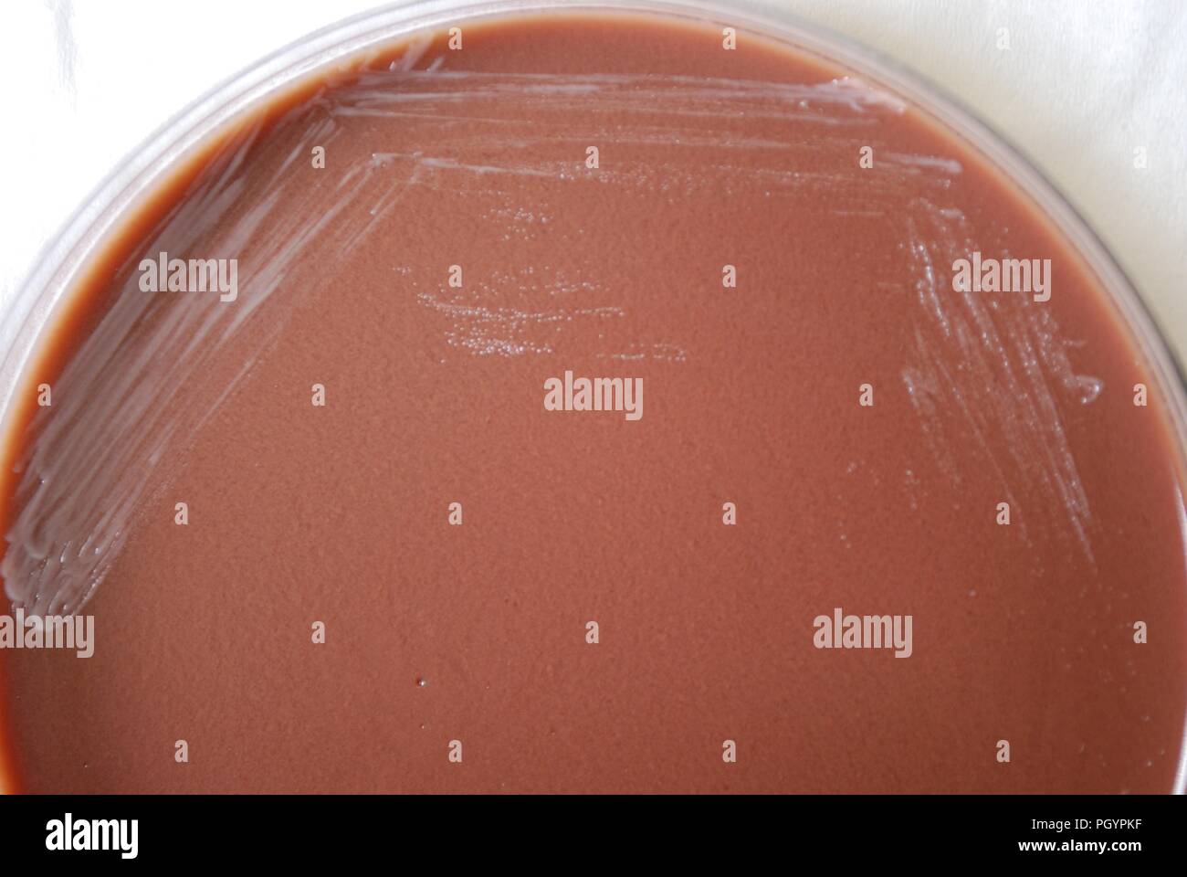 Morfologia coloniale di batteri Gram-negativi Brucella abortus batteri cresciuti 48 ore su un terreno di agar cioccolato, 2010. Immagine cortesia di centri per il controllo delle malattie (CDC) / Dr Todd Parker, Audra Marsh. () Foto Stock