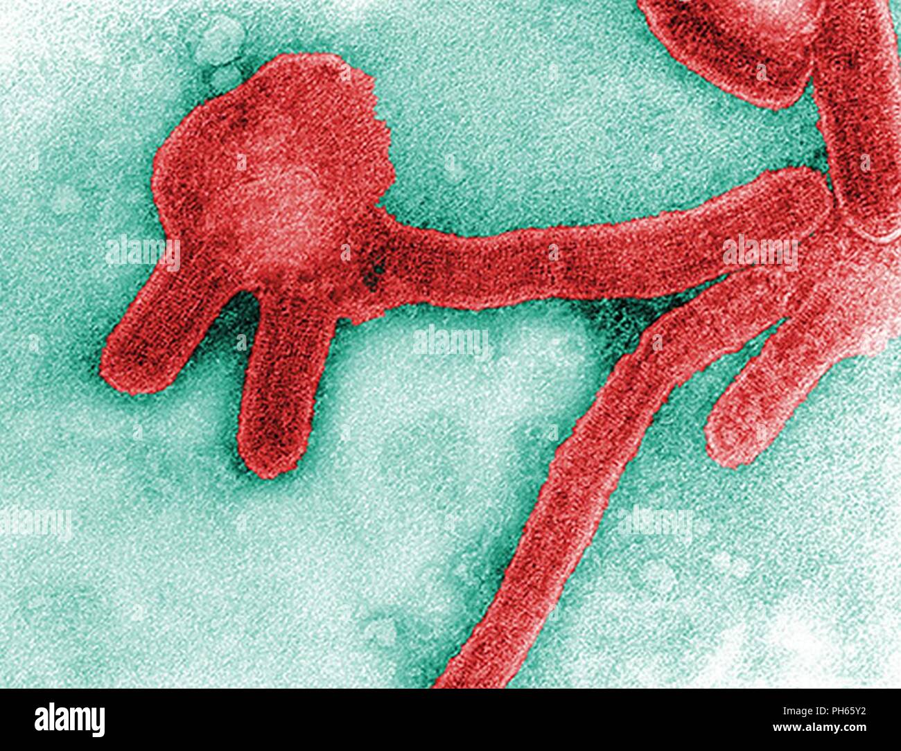 1968 F. A. Murphy; Cynthia Goldsmith questo colorato colorato negativo microscopio elettronico a trasmissione (TEM), acquisite da F.A. Murphy nel 1968, illustra un certo numero di virus di Marburg virioni, che erano state coltivate in un ambiente di cellule di coltura tissutale. Marburg febbre emorragica è un raro tipo di grave di febbre emorragica che interessa sia gli esseri umani e i primati non umani. Causato da un unico geneticamente (zoonotici che è, animale-borne) RNA virus della famiglia filovirus, il suo riconoscimento ha portato alla creazione di questa famiglia di virus. Le quattro specie di virus Ebola sono gli unici altri noti organi di th Foto Stock