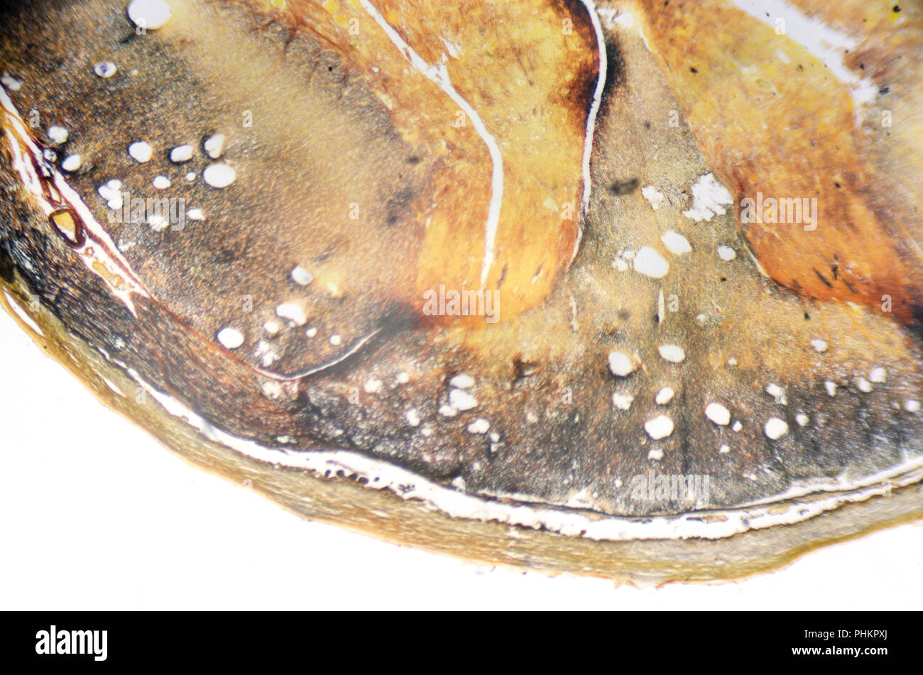 Fotografia al microscopio. Il midollo spinale, la sezione trasversale. Foto Stock