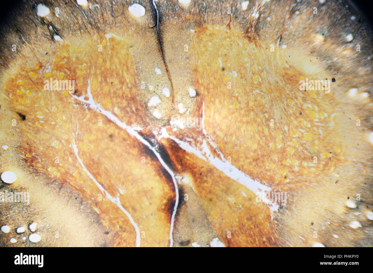 Fotografia al microscopio. Il midollo spinale, la sezione trasversale Foto  stock - Alamy