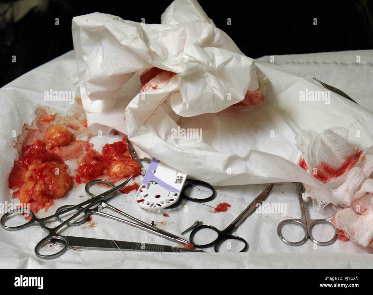 Pulizia di rifiuti medici dopo un intervento chirurgico Foto Stock