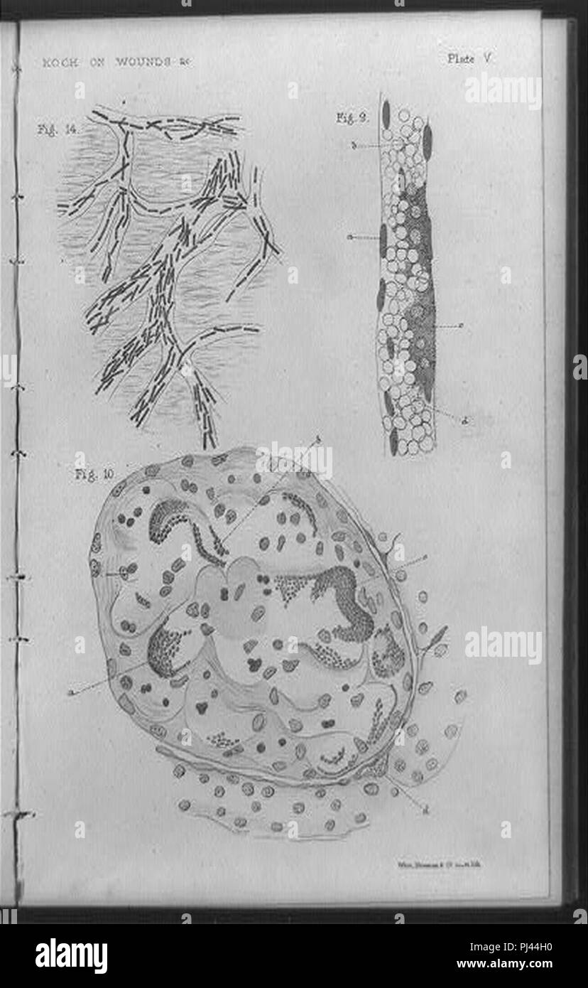 Batteri trovati nelle ferite come disegnato da una fotomicrografia) - Ovest, Newman & Co., scolpire. lith Foto Stock