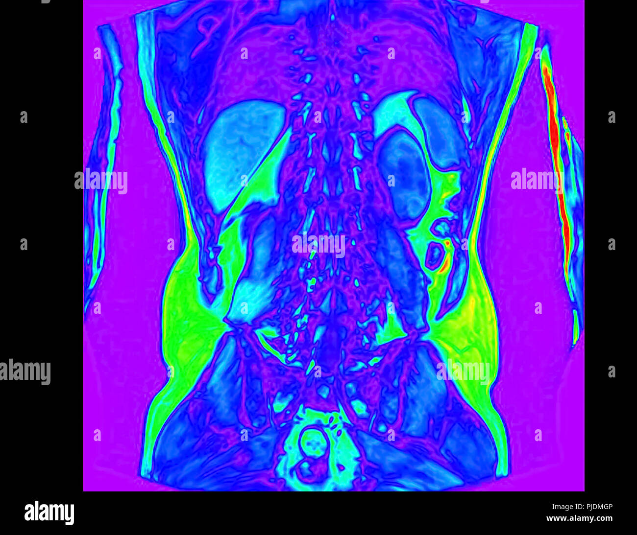 Anatomia Addome Maschile Immagini e Fotos Stock Alamy