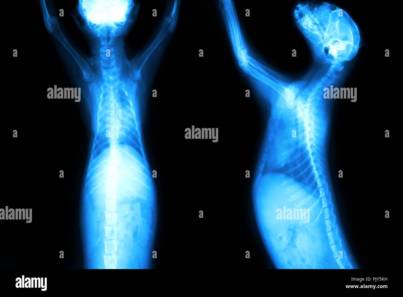 Nodulo di radiografia x-ray rileva cane principali anormalità del torace con intelligenza artificiale (AI), una tecnologia di rilevamento. Smart medico , healthcare imag Foto Stock