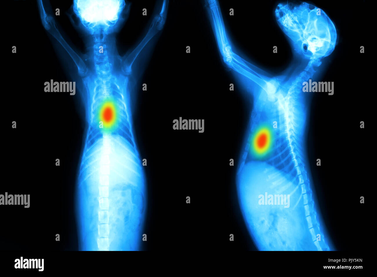 Nodulo di radiografia x-ray rileva cane principali anormalità del torace con intelligenza artificiale (AI), una tecnologia di rilevamento. Smart medico , healthcare imag Foto Stock