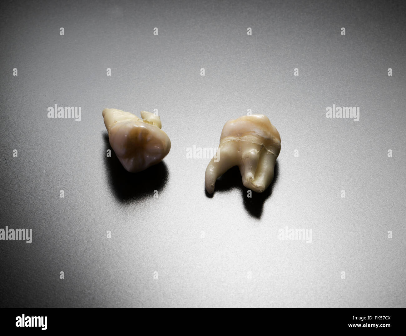Denti umani. Rimozione di saggezza denti. Estrazione dentale di adulti molari. Denti isolati. Foto Stock