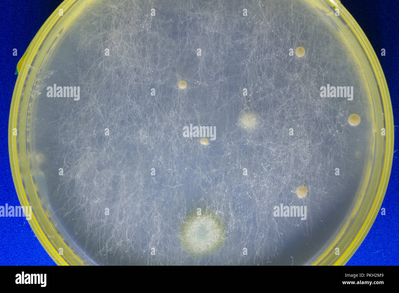 Piastra di petri con organismi patogeni Foto Stock