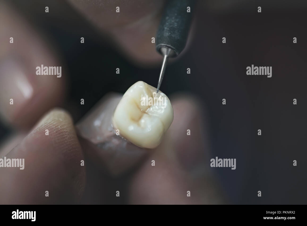 Dente artificiale. Foto Stock
