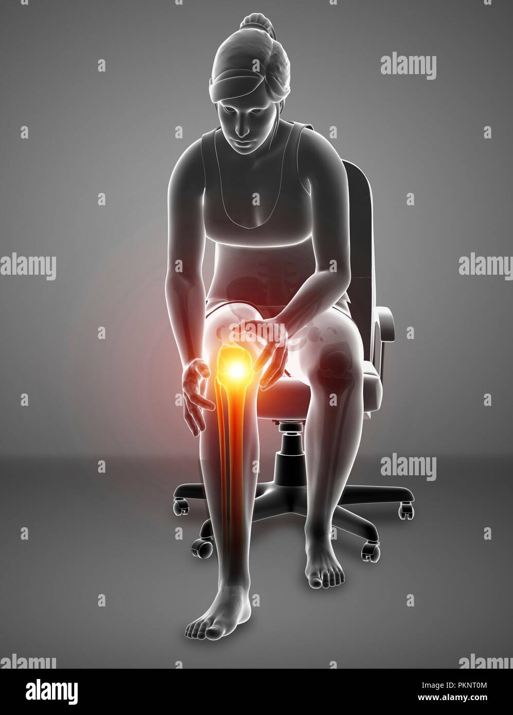 Donna con il dolore al ginocchio, illustrazione del computer. Foto Stock