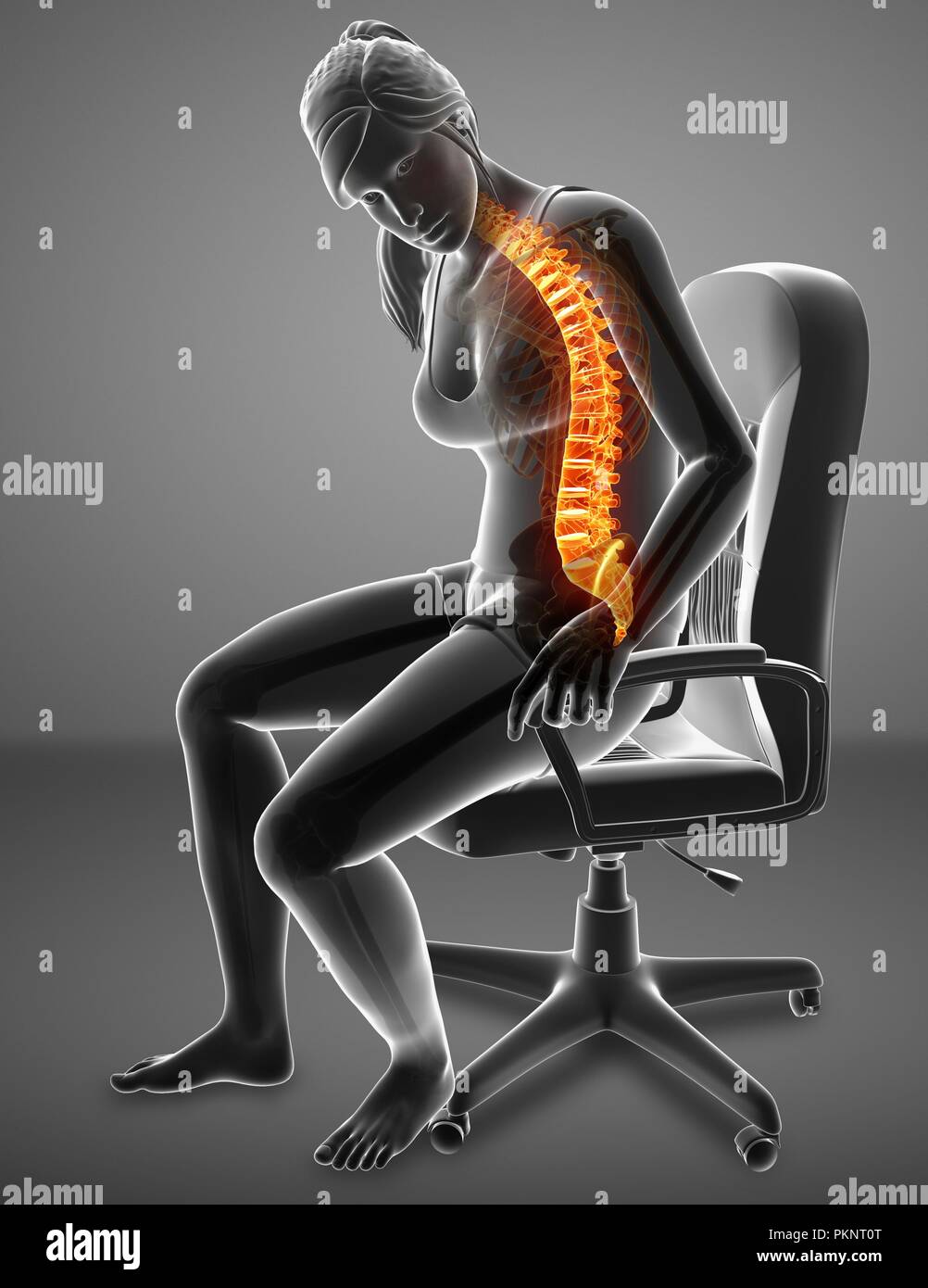 Donna con dolore alla schiena, illustrazione del computer. Foto Stock