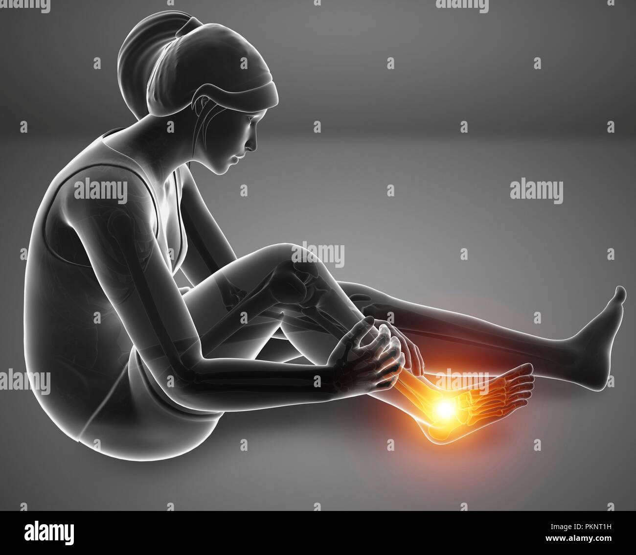 Donna con piede dolore, illustrazione del computer. Foto Stock
