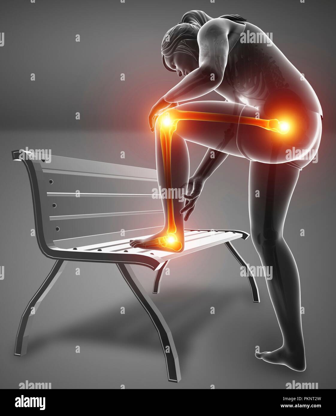 Donna con dolore alle gambe, illustrazione del computer. Foto Stock