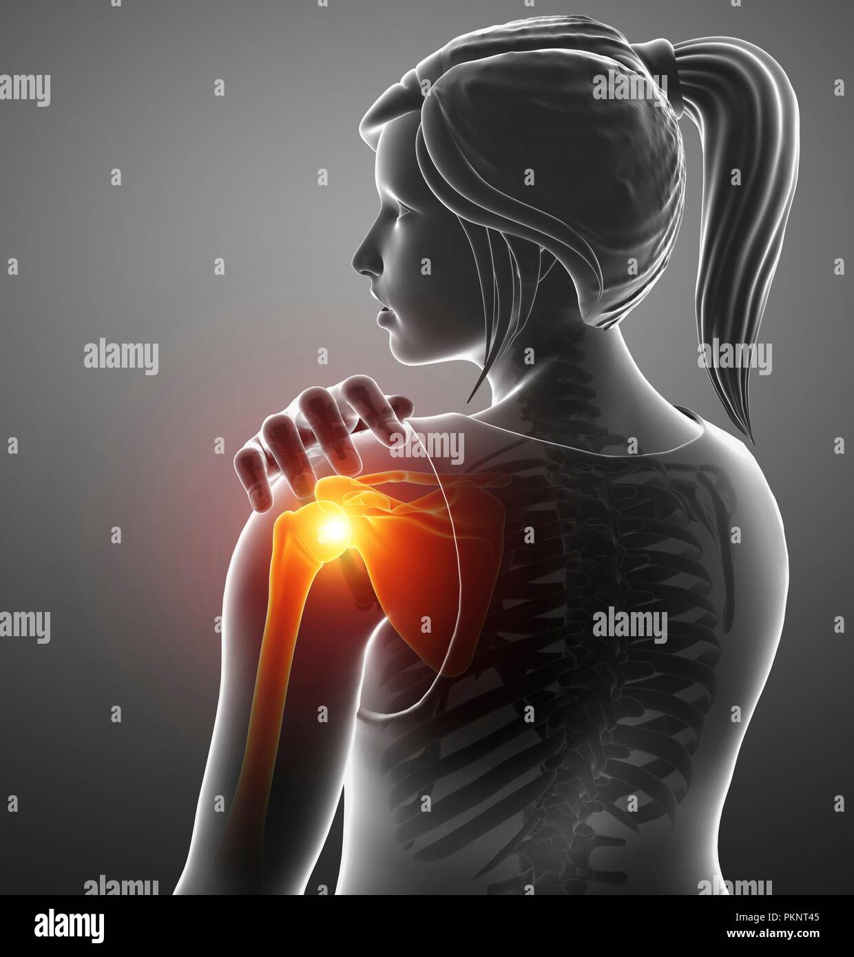 Donna con una spalla dolorosa, illustrazione del computer. Foto Stock