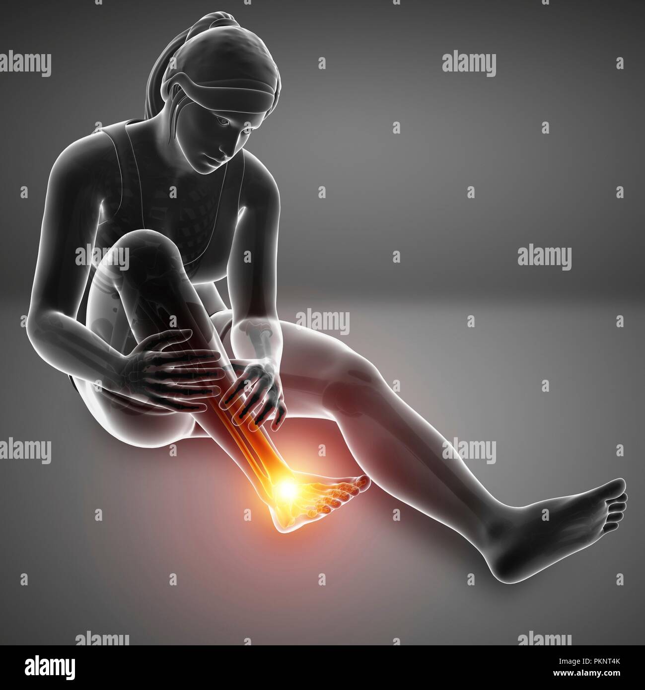 Donna con piede dolore, illustrazione del computer. Foto Stock
