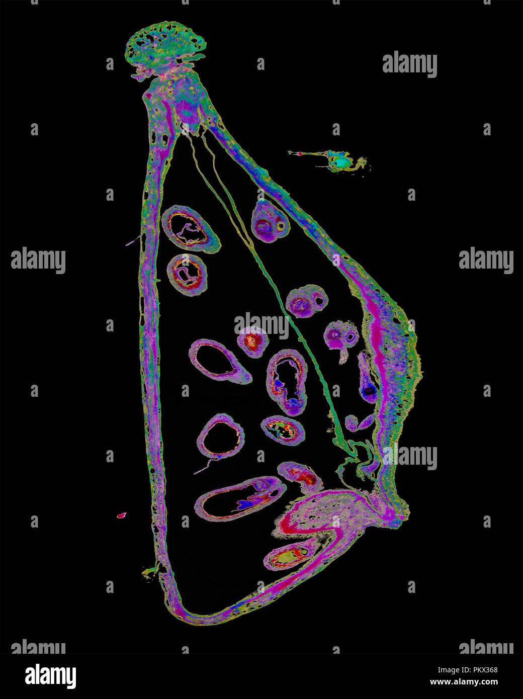 Micro Fotografia di pastore la borsa embrione maturo Capsella Foto Stock