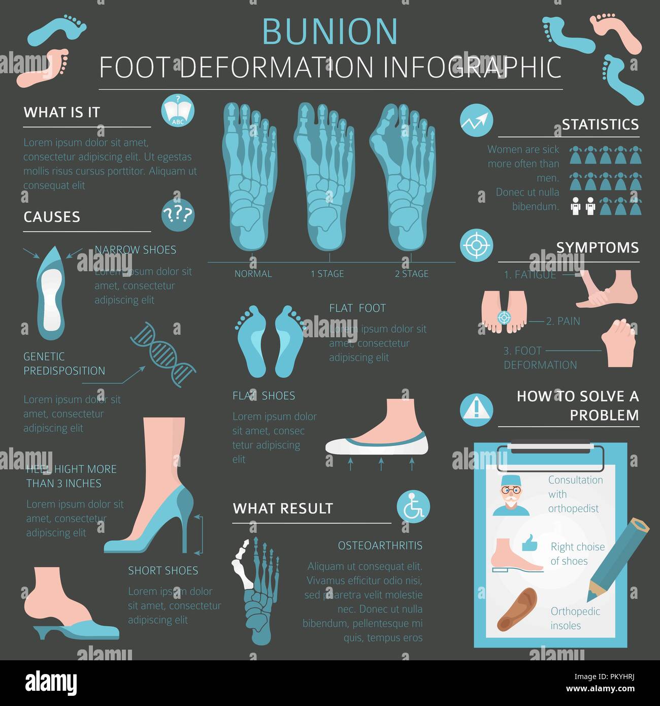 La deformazione del piede come malattia medica ed infografico. Cause di bunion. Illustrazione Vettoriale Illustrazione Vettoriale