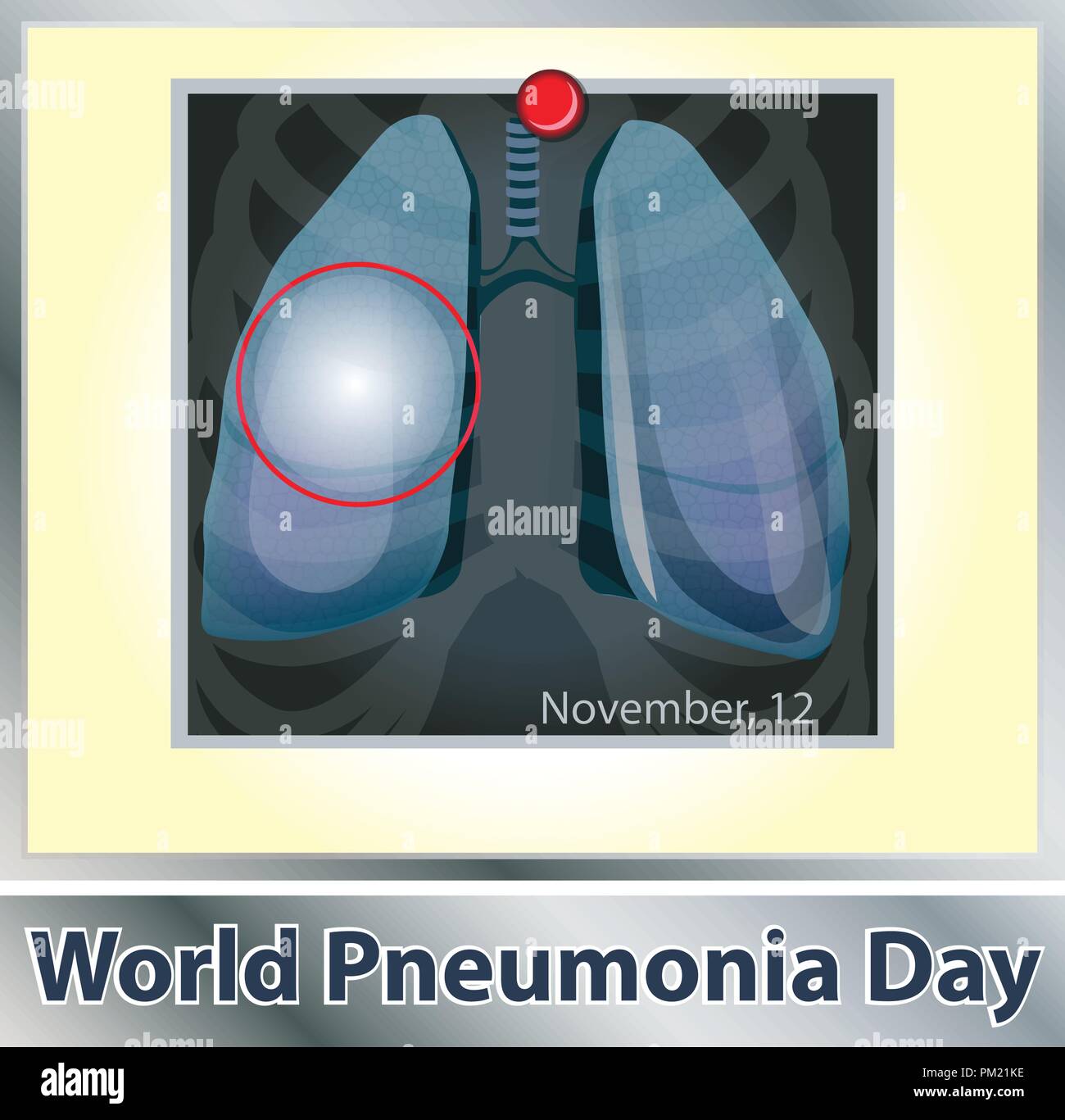 Simbolo di patologia polmonare. La respirazione. Il sistema respiratorio. Malattie respiratorie - cancro asma, tubercolosi, polmonite . Mondo polmonite giorno. Assistenza sanitaria. X-ray dei polmoni Illustrazione Vettoriale