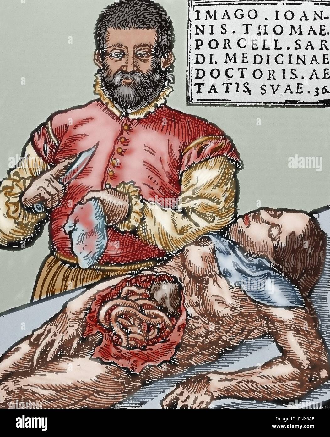 Giovanni Tommaso Porcell (1528-ca.1580). Medico spagnolo. Autopsia. Incisione colorata. Foto Stock