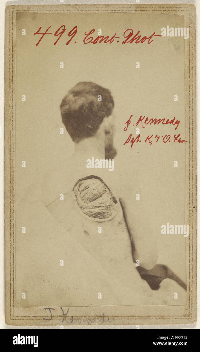 John Kennedy Sgt. Co. K. 7 Ohio Calvry; attribuita a William H. Bell, americano, 1830 - 1910, 1864; albume silver stampa Foto Stock