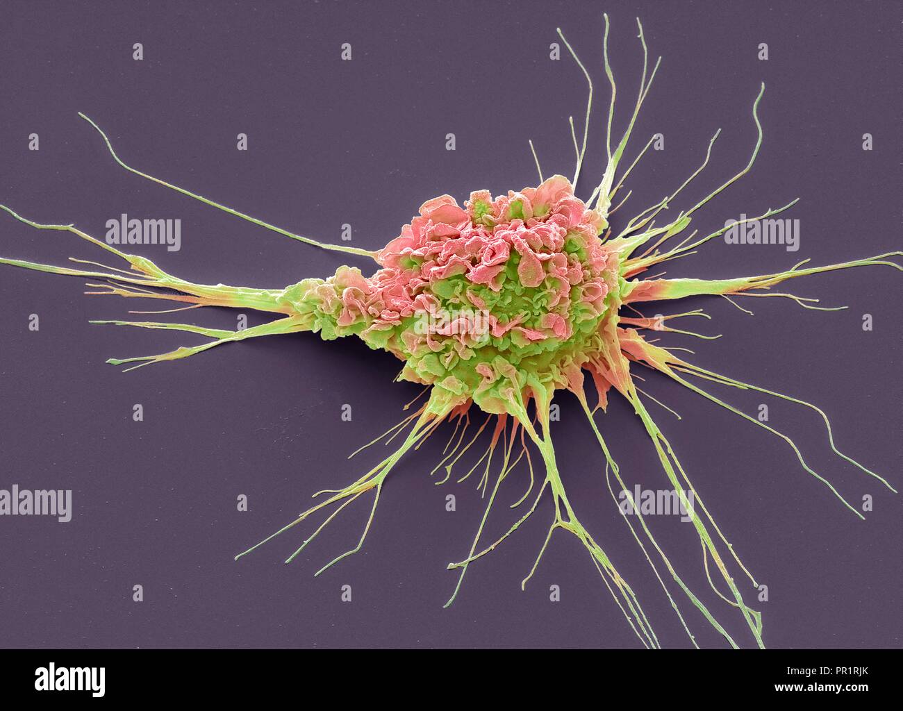 Cellula dendritica. Color scanning electron microfotografia (SEM) di una cella di protezione del sistema immunitario umano noto come una cellula dendritica. Le sporgenze lungo visto sul cellulare della superficie sono 'piedi' per aiutare a muoversi. Queste cellule processo antigeni estranei che quindi agire come un segnale di allarme, allarme altre cellule immunitarie del corpo alle infezioni. Le cellule dendritiche trovati nello strato superiore della pelle (epidermide) sono noti come histiocytes o cellule di Langerhans. Nel sistema nervoso centrale sono noti come cellule microgliali e nel fegato come cellule Kupffer. Ingrandimento:x 3000 quando stampata a 10 cm di larghezza. Foto Stock