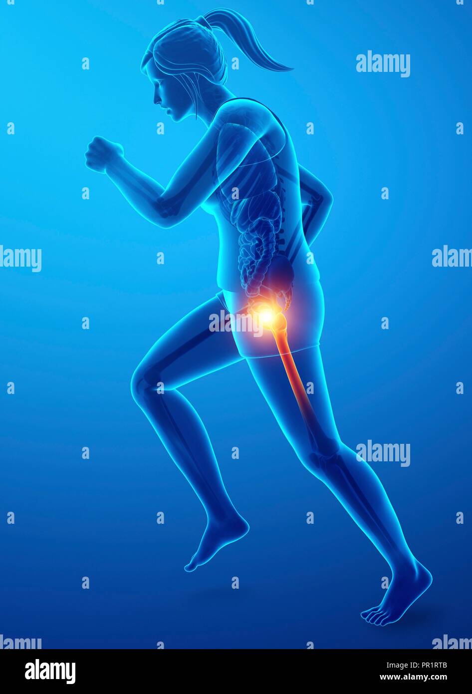 Donna con hip dolore, illustrazione del computer. Foto Stock