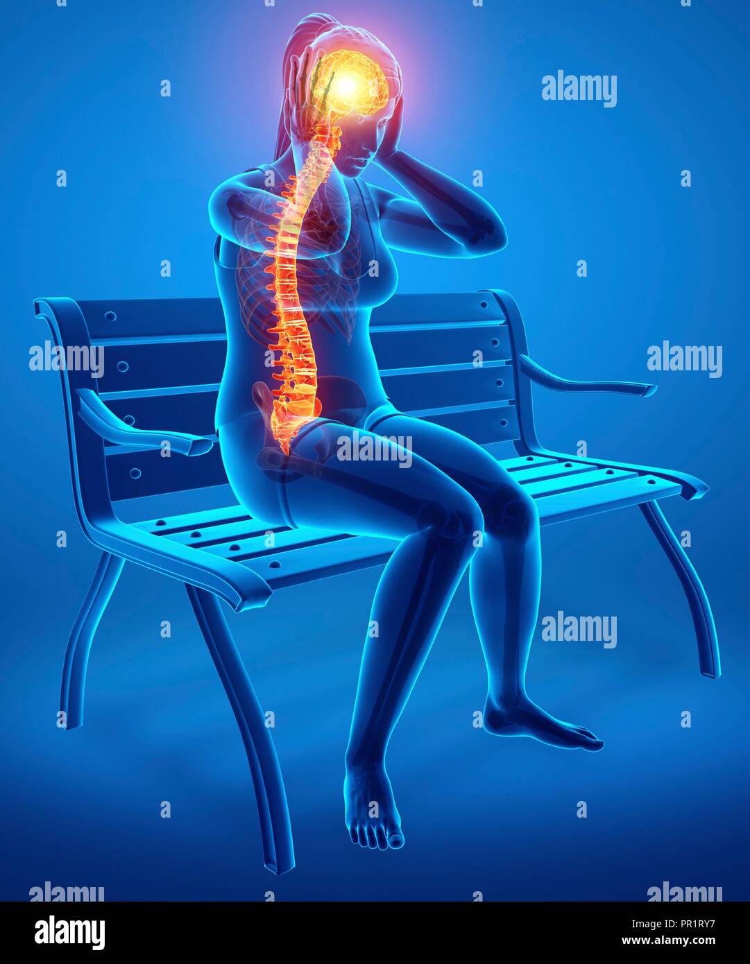 Donna con dolore alla schiena, illustrazione del computer. Foto Stock