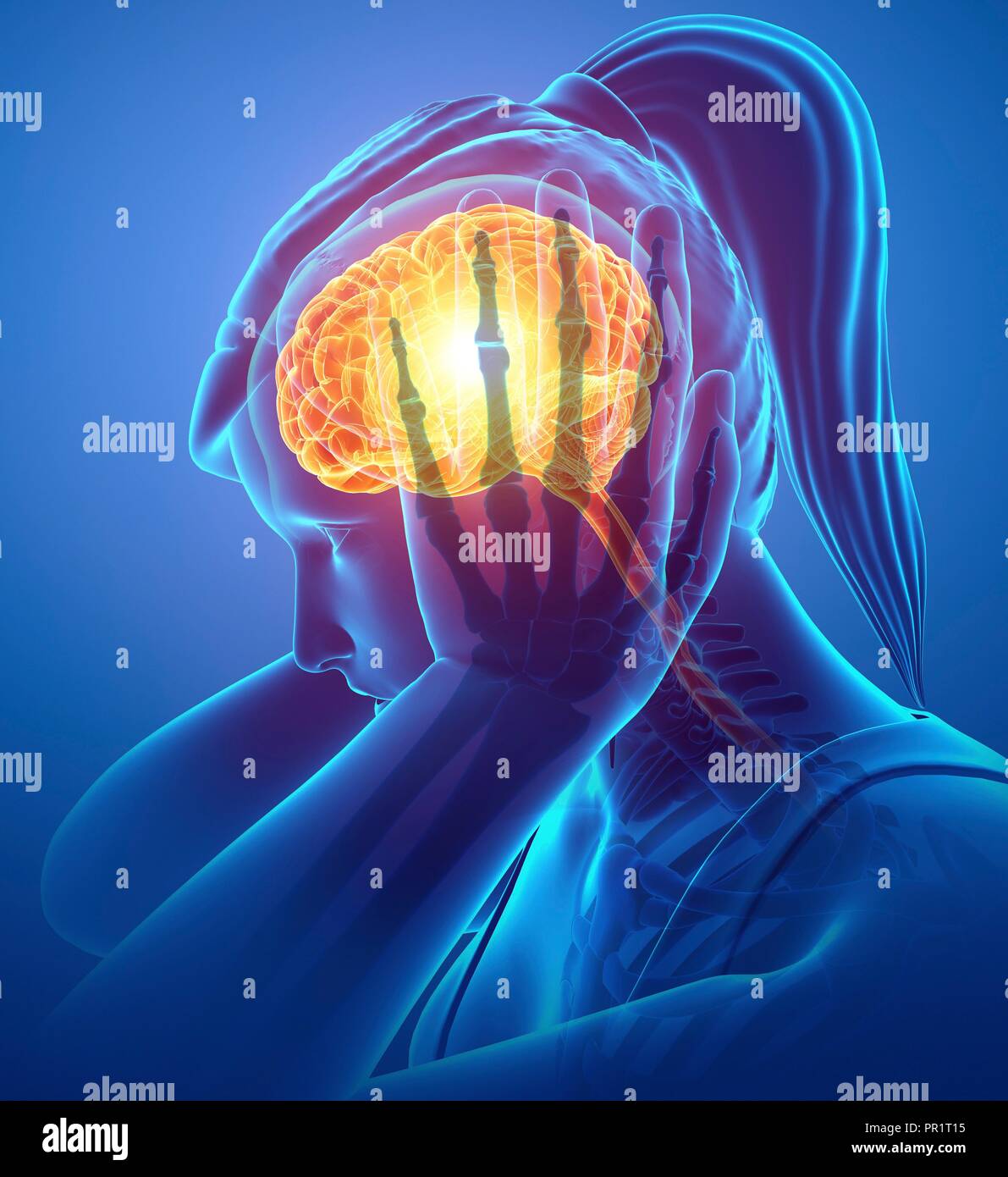 Donna con mal di testa, illustrazione del computer. Foto Stock