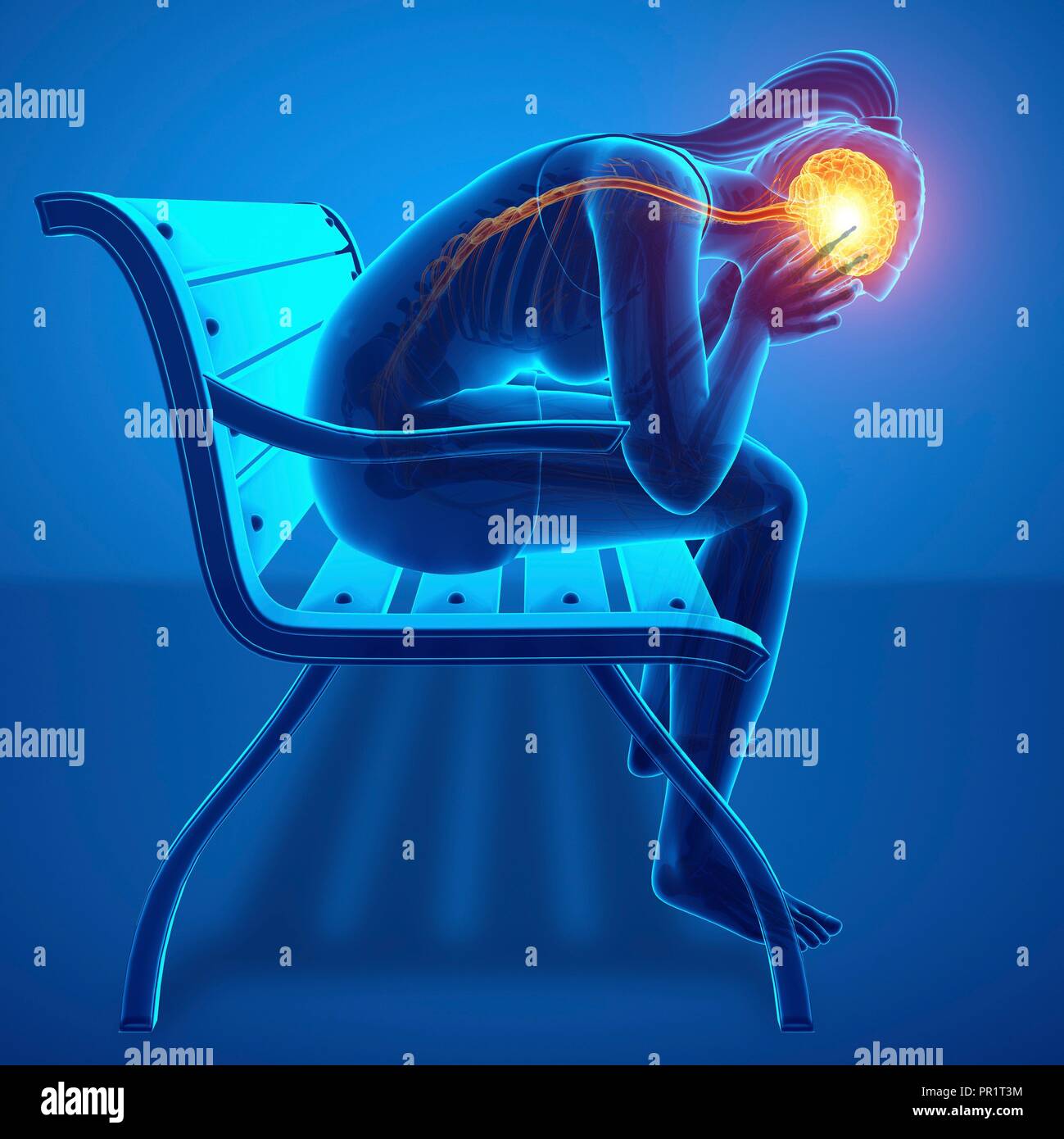 Donna con mal di testa, illustrazione del computer. Foto Stock