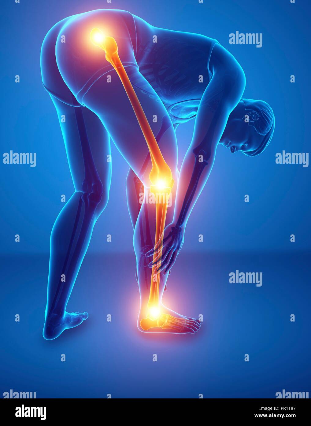 Uomo con il dolore al ginocchio, illustrazione del computer. Foto Stock