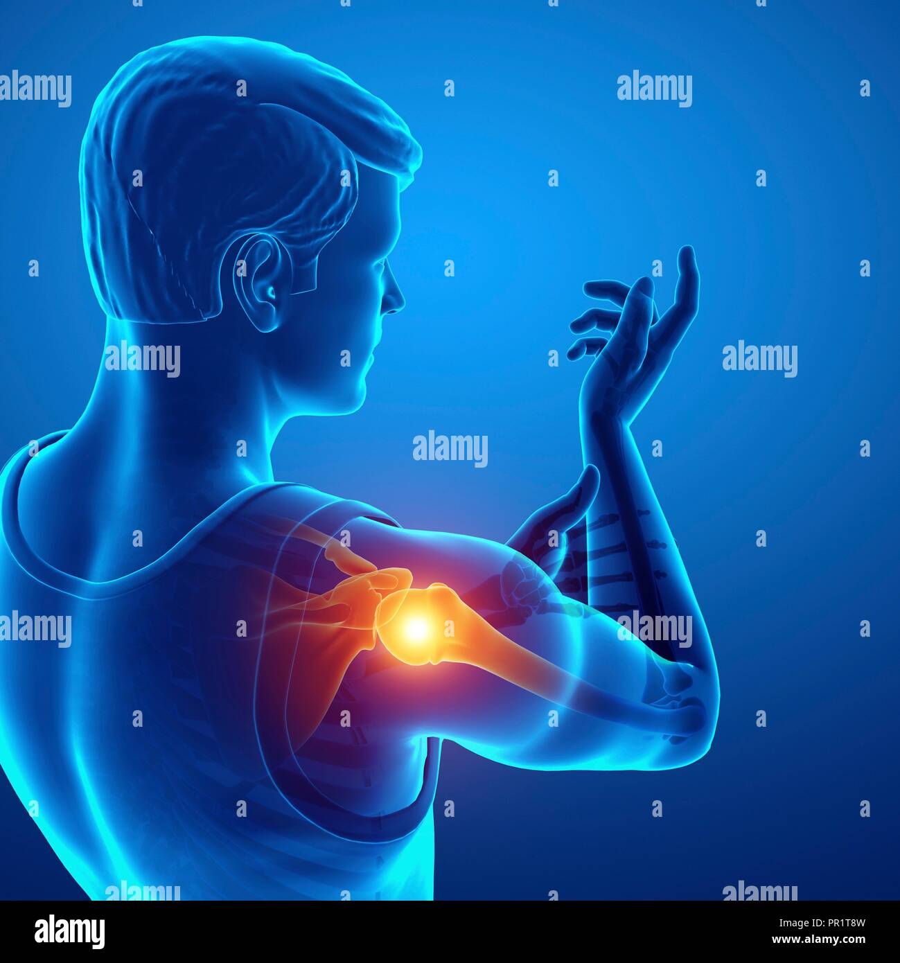 Uomo con dolore alla spalla, illustrazione del computer. Foto Stock