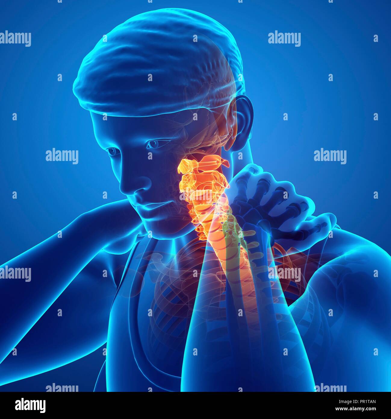 Uomo con dolore al collo, illustrazione del computer. Foto Stock