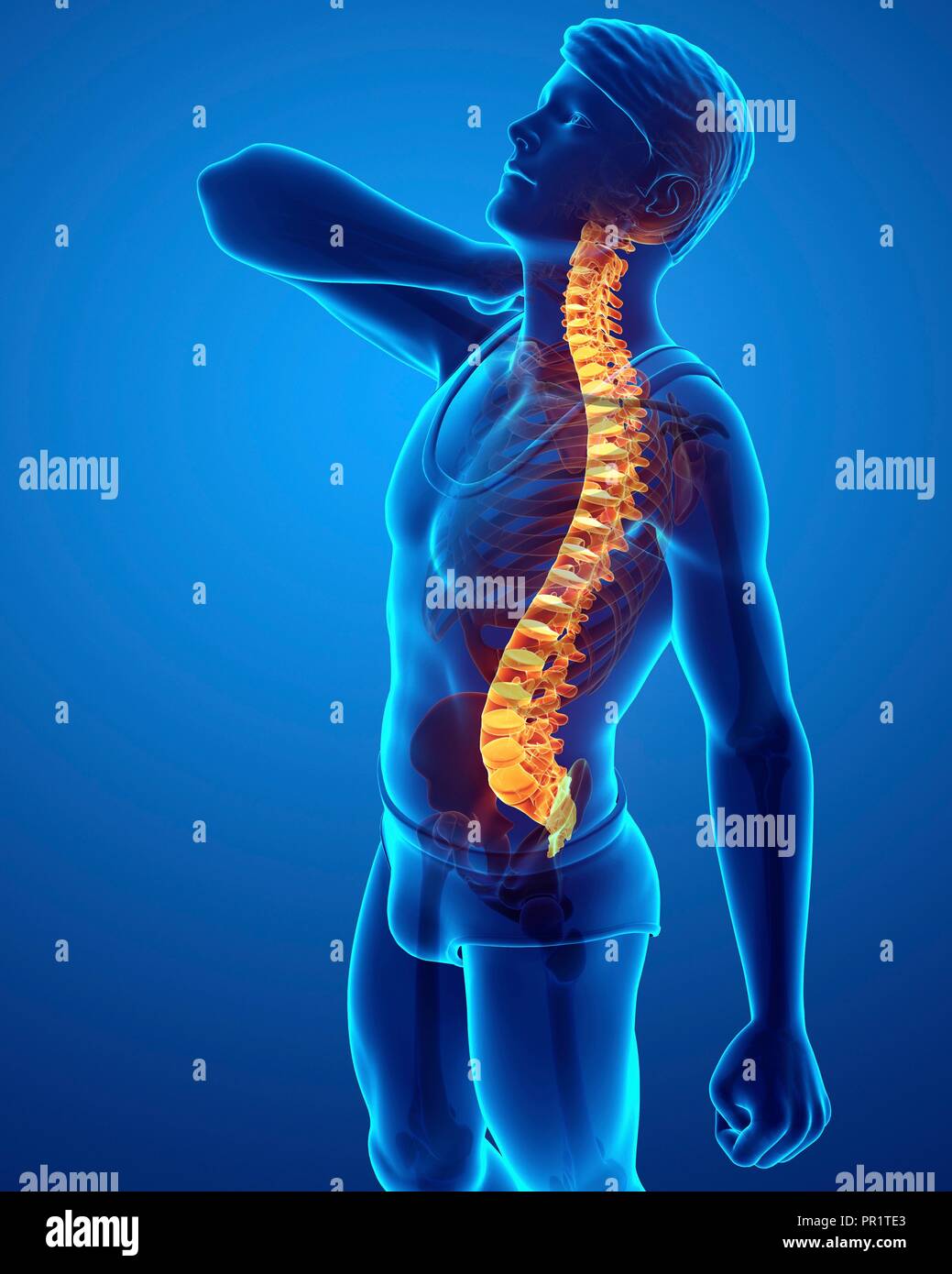 Uomo con il mal di schiena, illustrazione del computer. Foto Stock