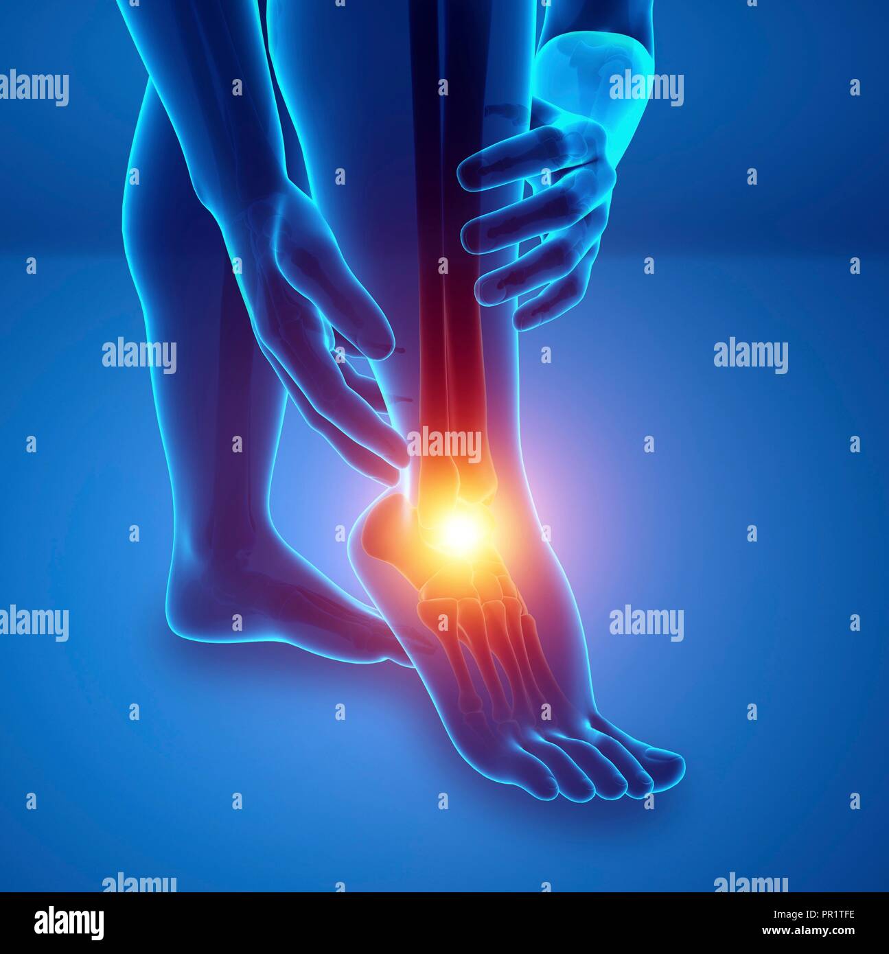 Uomo con piede dolore, illustrazione del computer. Foto Stock