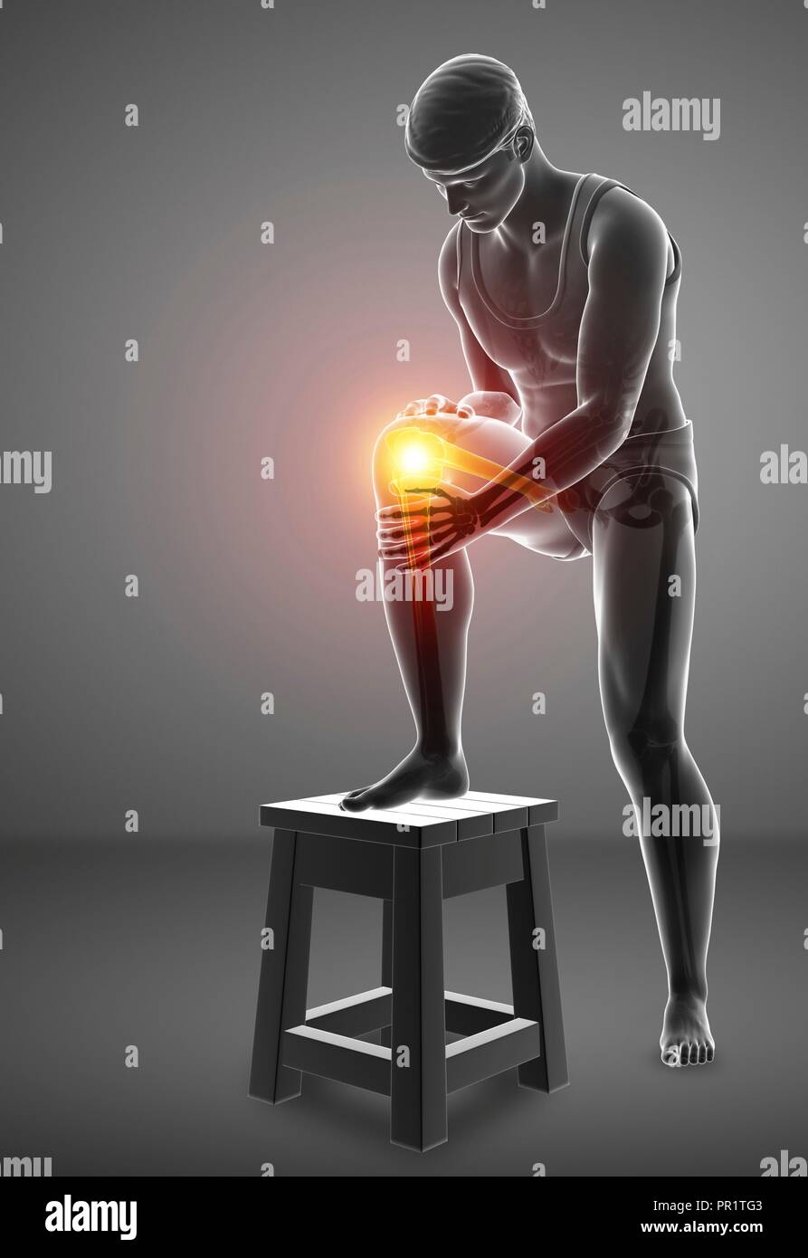 Uomo con il dolore al ginocchio, illustrazione del computer. Foto Stock
