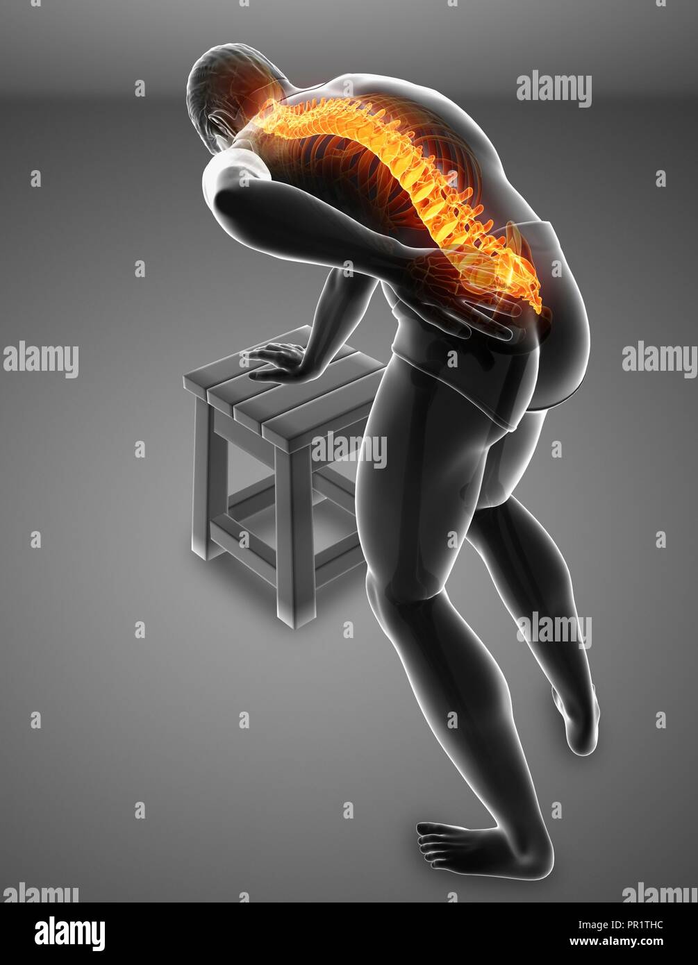 Uomo con il mal di schiena, illustrazione del computer. Foto Stock