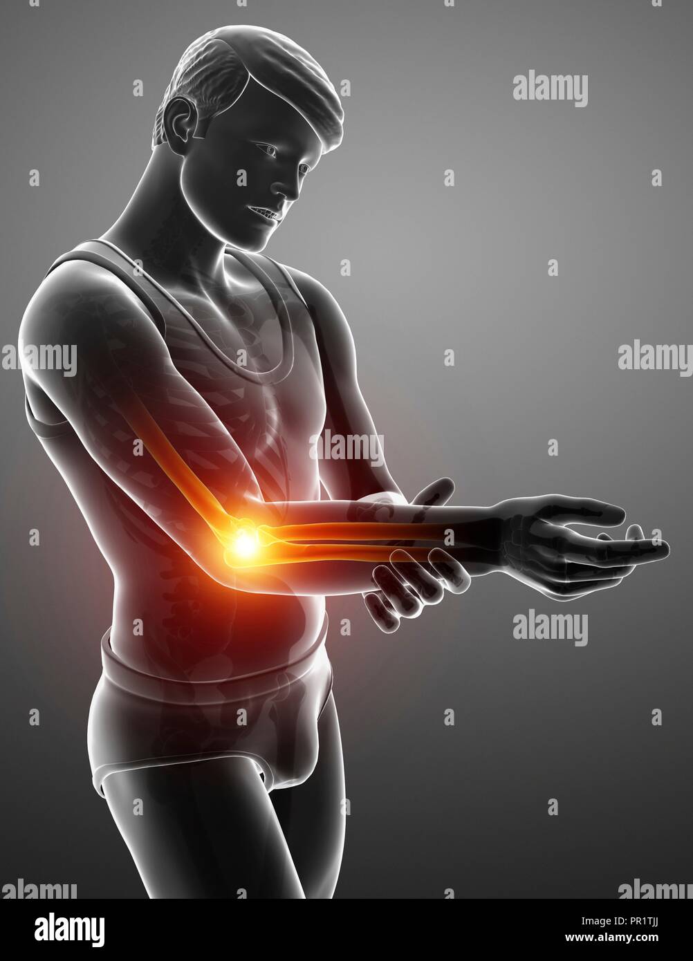 L'uomo con il gomito dolore, illustrazione del computer. Foto Stock