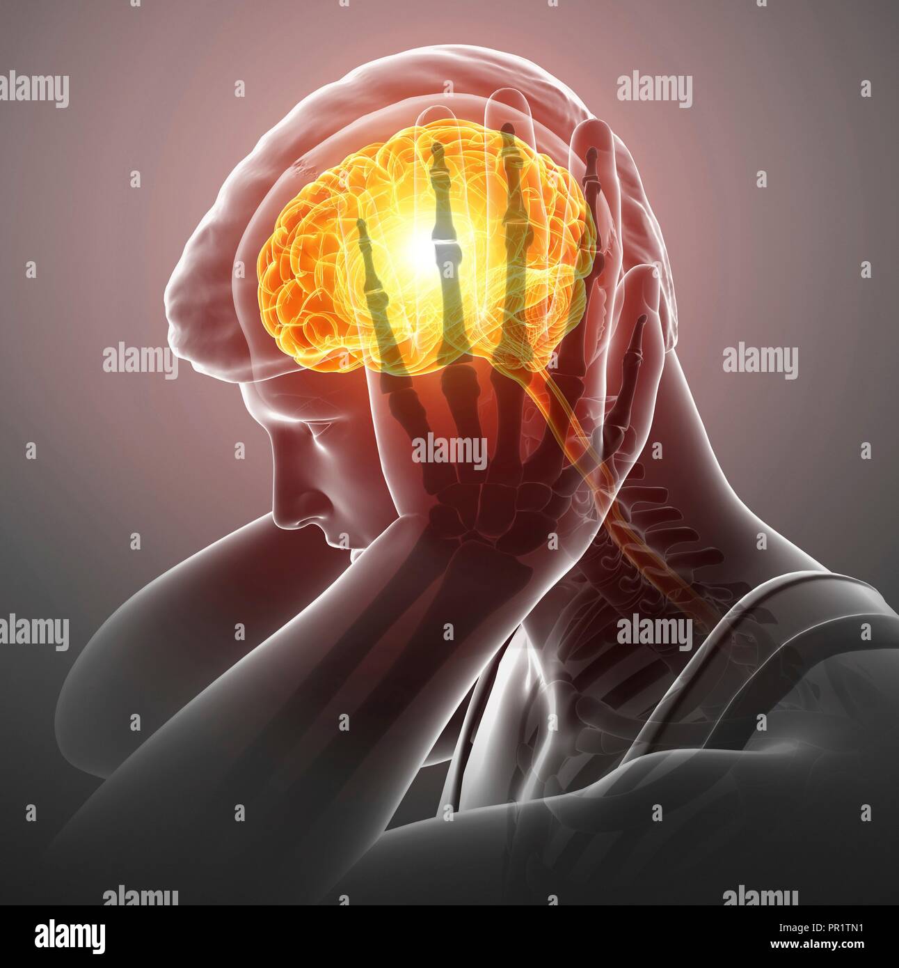 Uomo con cefalea, illustrazione del computer. Foto Stock