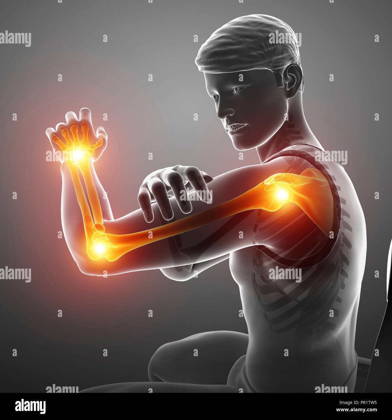 Uomo con dolore al braccio, illustrazione del computer. Foto Stock